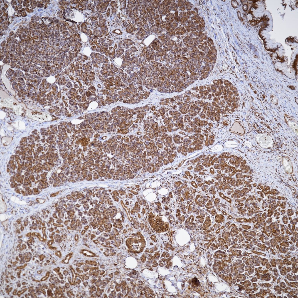 Immunohistochemistry (IHC) staining of human pancreas tissue using ERK1/2 Recombinant monoclonal antibody (83533-1-RR)