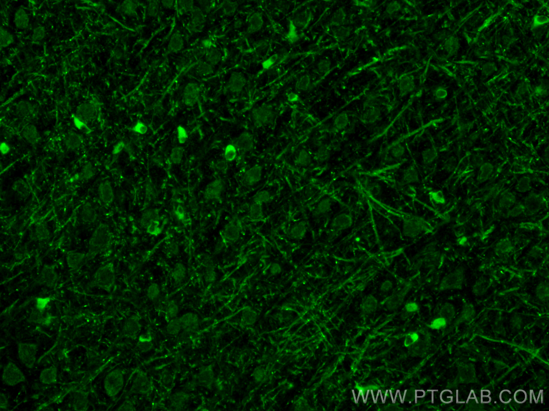 Immunofluorescence (IF) / fluorescent staining of mouse brain tissue using ERMN Polyclonal antibody (31432-1-AP)