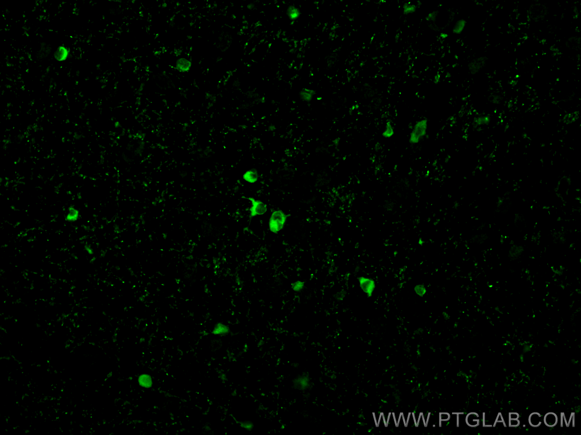 Immunofluorescence (IF) / fluorescent staining of rat brain tissue using ERMN Polyclonal antibody (31432-1-AP)