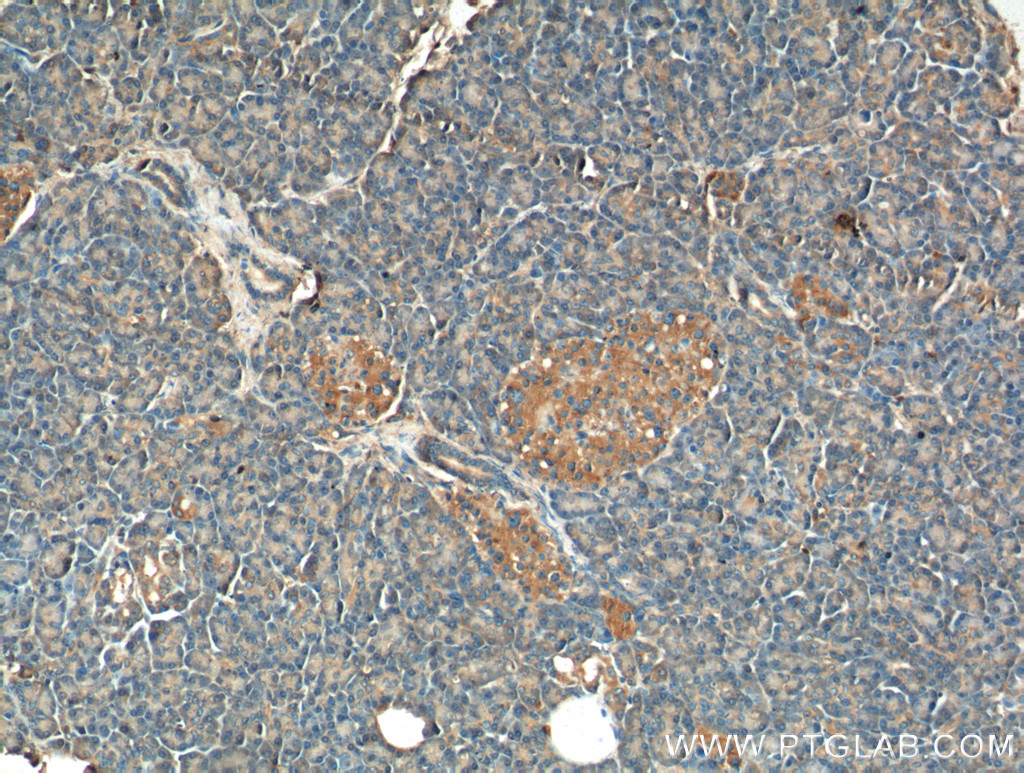 Immunohistochemistry (IHC) staining of human pancreas tissue using ERO1LB Polyclonal antibody (18312-1-AP)