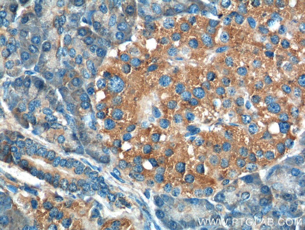 Immunohistochemistry (IHC) staining of human pancreas tissue using ERO1LB Polyclonal antibody (18312-1-AP)