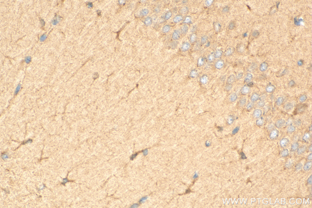 Immunohistochemistry (IHC) staining of mouse brain tissue using TXNDC4 Polyclonal antibody (16016-1-AP)