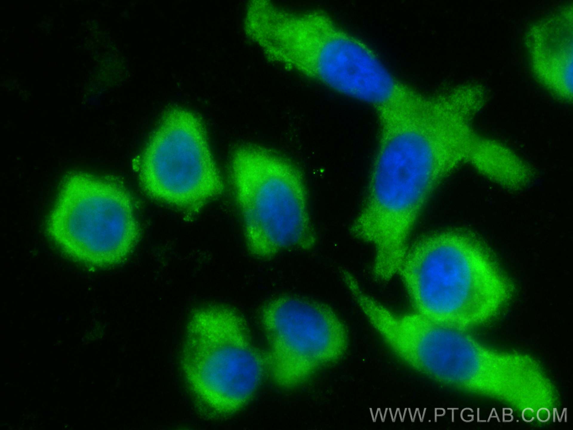 Immunofluorescence (IF) / fluorescent staining of PC-3 cells using CoraLite® Plus 488-conjugated ERp72 Monoclonal ant (CL488-66365)