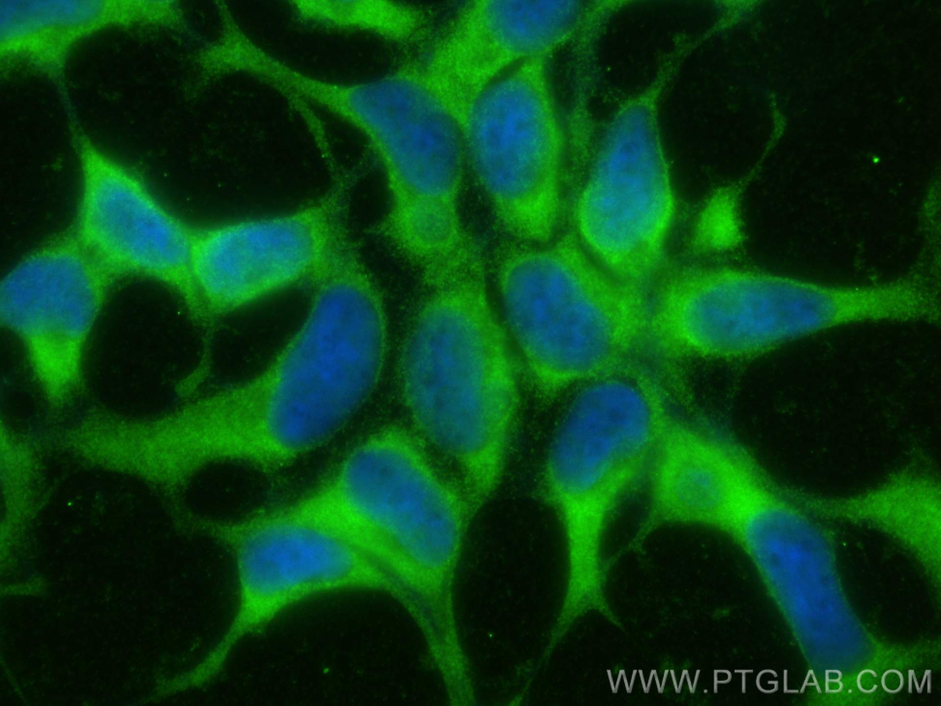 Immunofluorescence (IF) / fluorescent staining of HEK-293 cells using ESD Monoclonal antibody (67069-2-Ig)