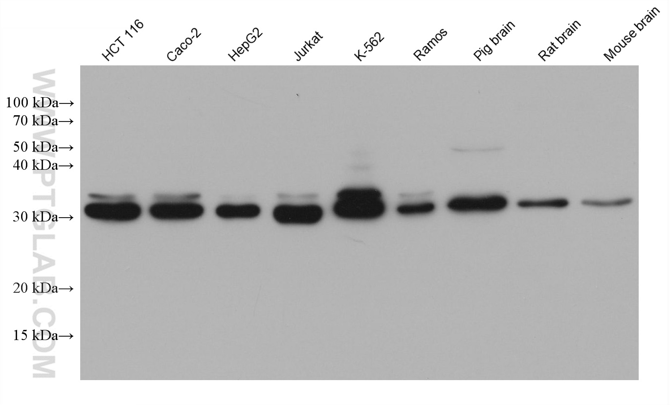 Western Blot (WB) analysis of various lysates using ESD Monoclonal antibody (67069-3-Ig)