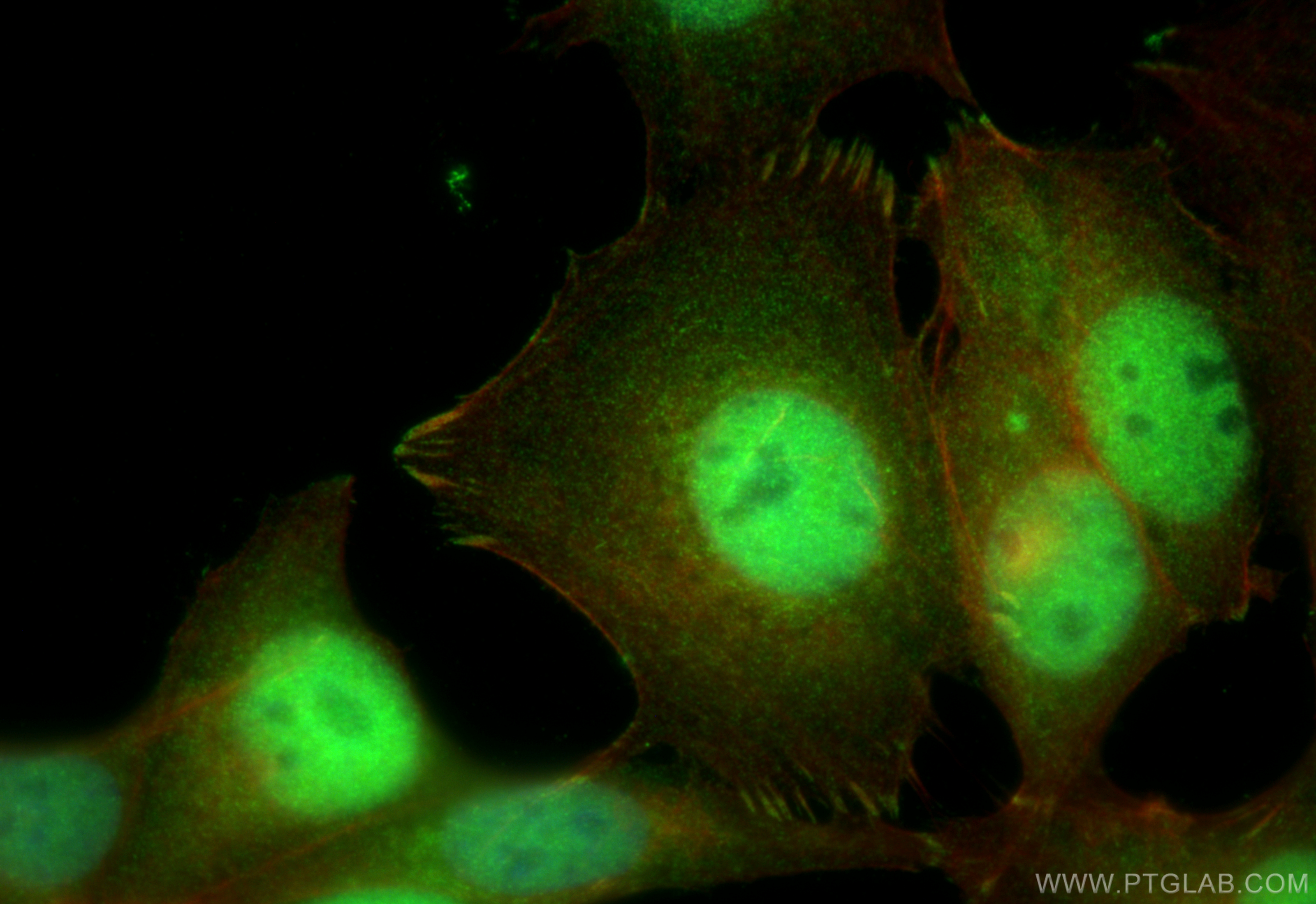 Immunofluorescence (IF) / fluorescent staining of MCF-7 cells using ER Polyclonal antibody (21244-1-AP)