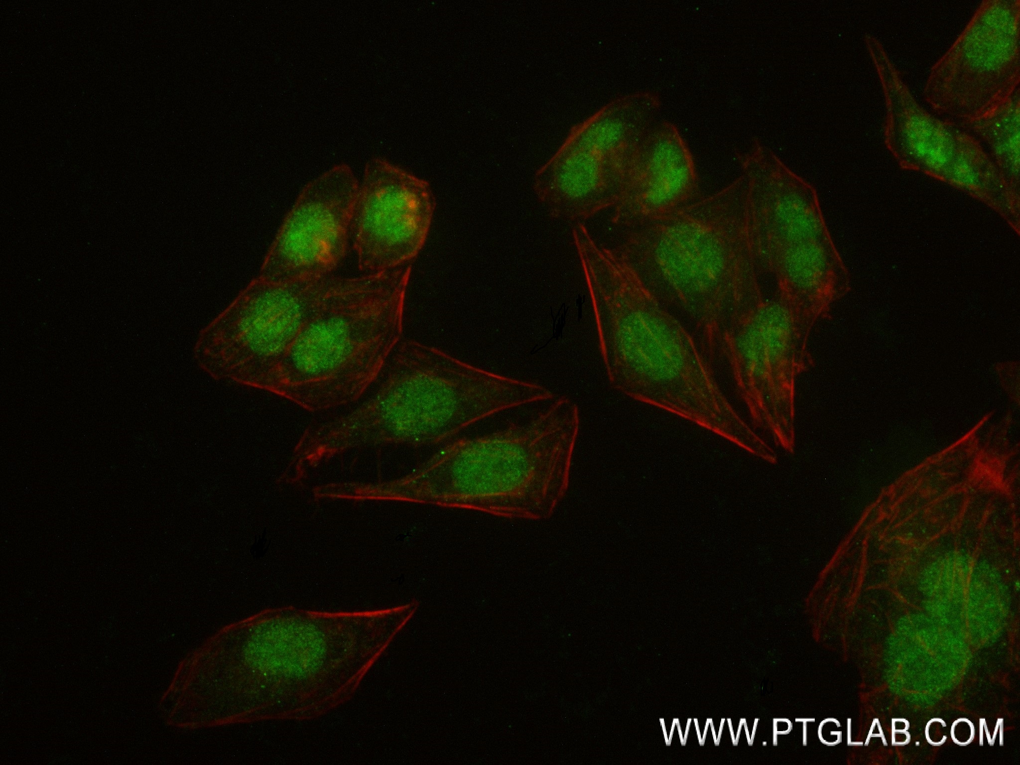 Immunofluorescence (IF) / fluorescent staining of HepG2 cells using ESR2 Recombinant antibody (83447-3-RR)