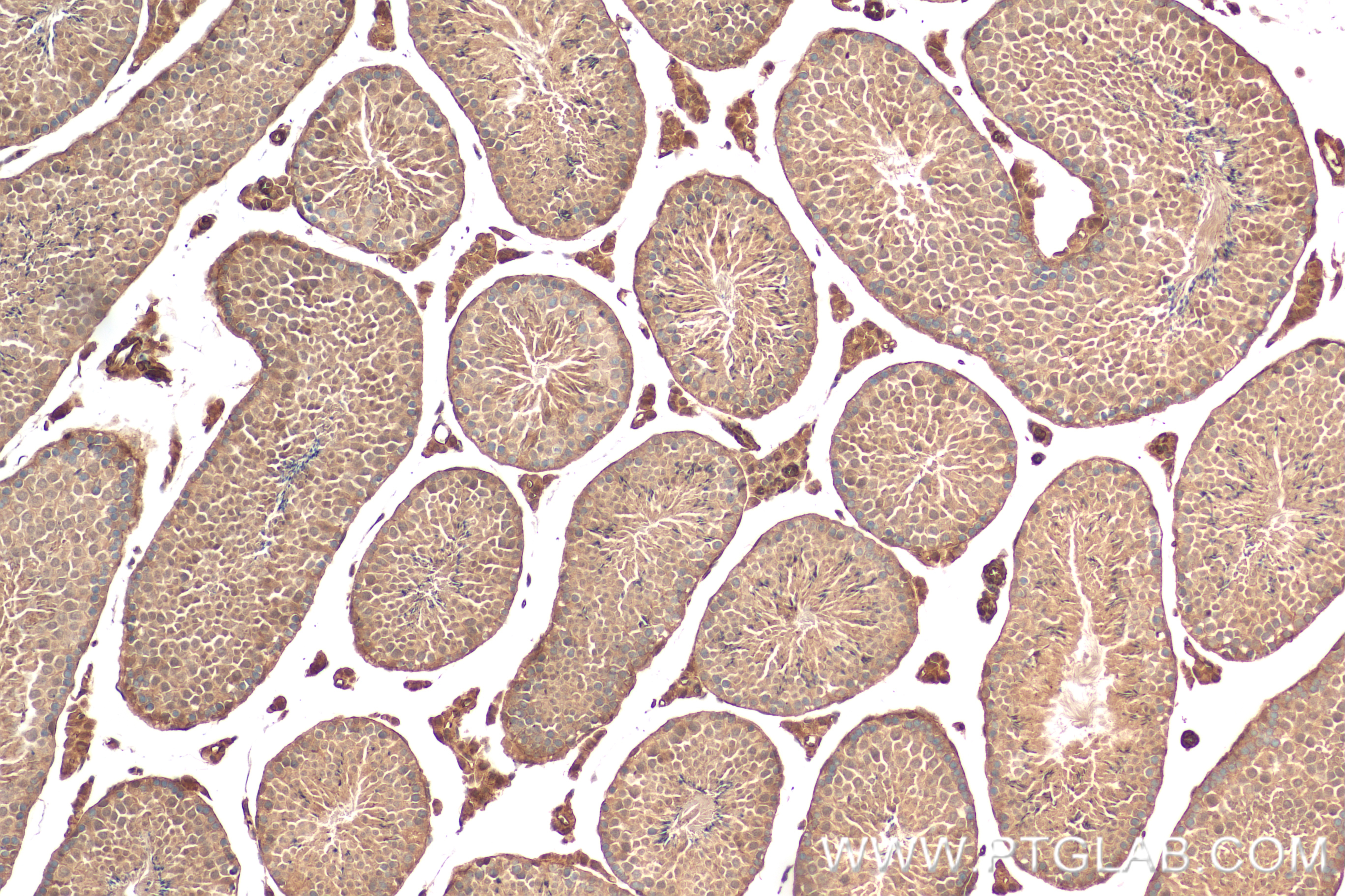 Immunohistochemistry (IHC) staining of mouse testis tissue using ESR2 Recombinant antibody (83447-3-RR)