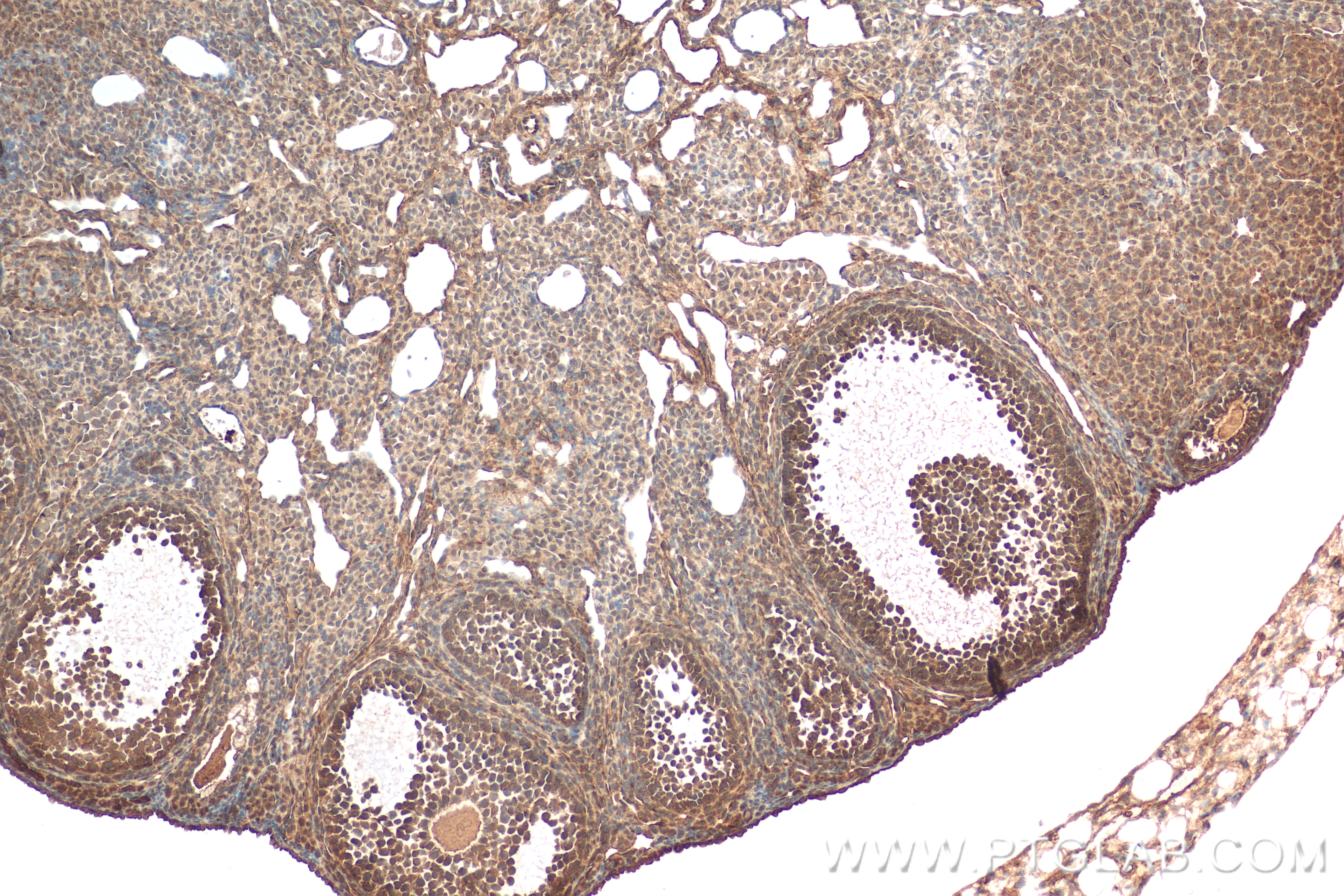 Immunohistochemistry (IHC) staining of mouse ovary tissue using ESR2 Recombinant antibody (83447-3-RR)