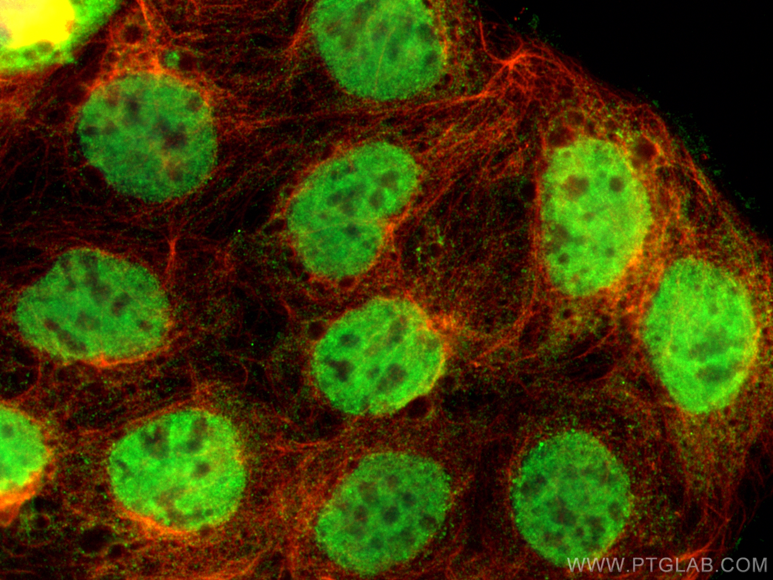 Immunofluorescence (IF) / fluorescent staining of Caco-2 cells using ESRRB Monoclonal antibody (66818-1-Ig)