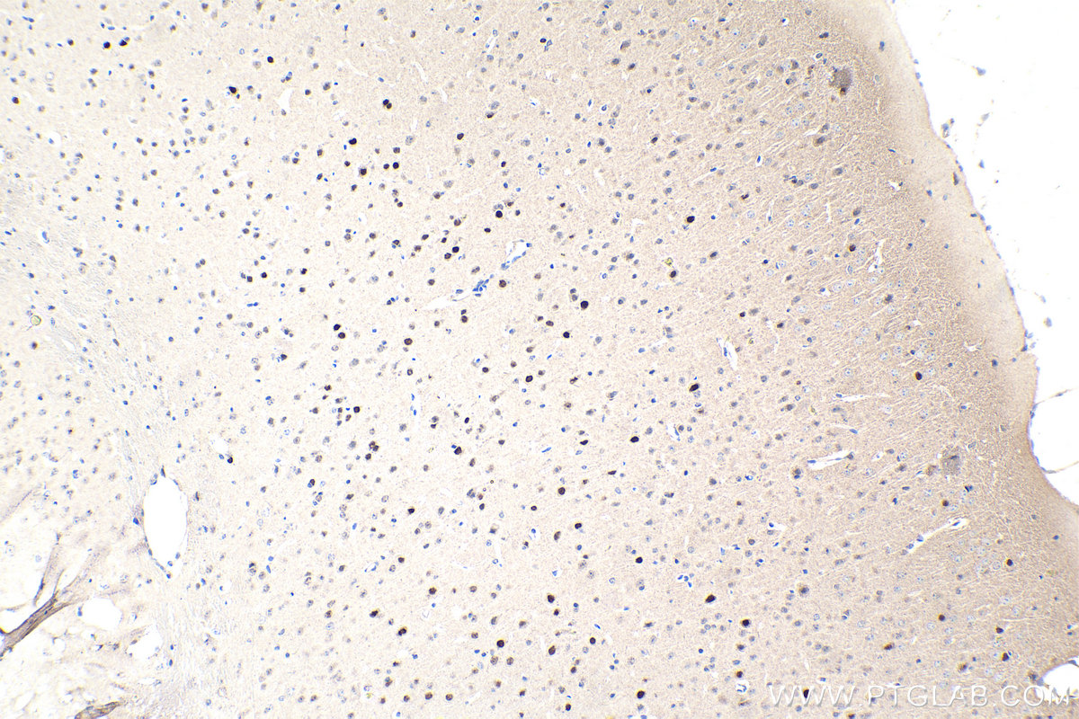 Immunohistochemistry (IHC) staining of mouse brain tissue using ESRRG Polyclonal antibody (14017-1-AP)