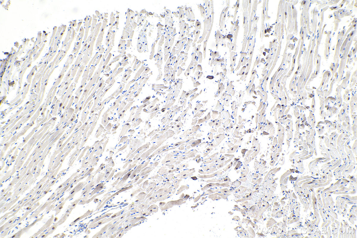 Immunohistochemistry (IHC) staining of mouse heart tissue using ESRRG Polyclonal antibody (14017-1-AP)