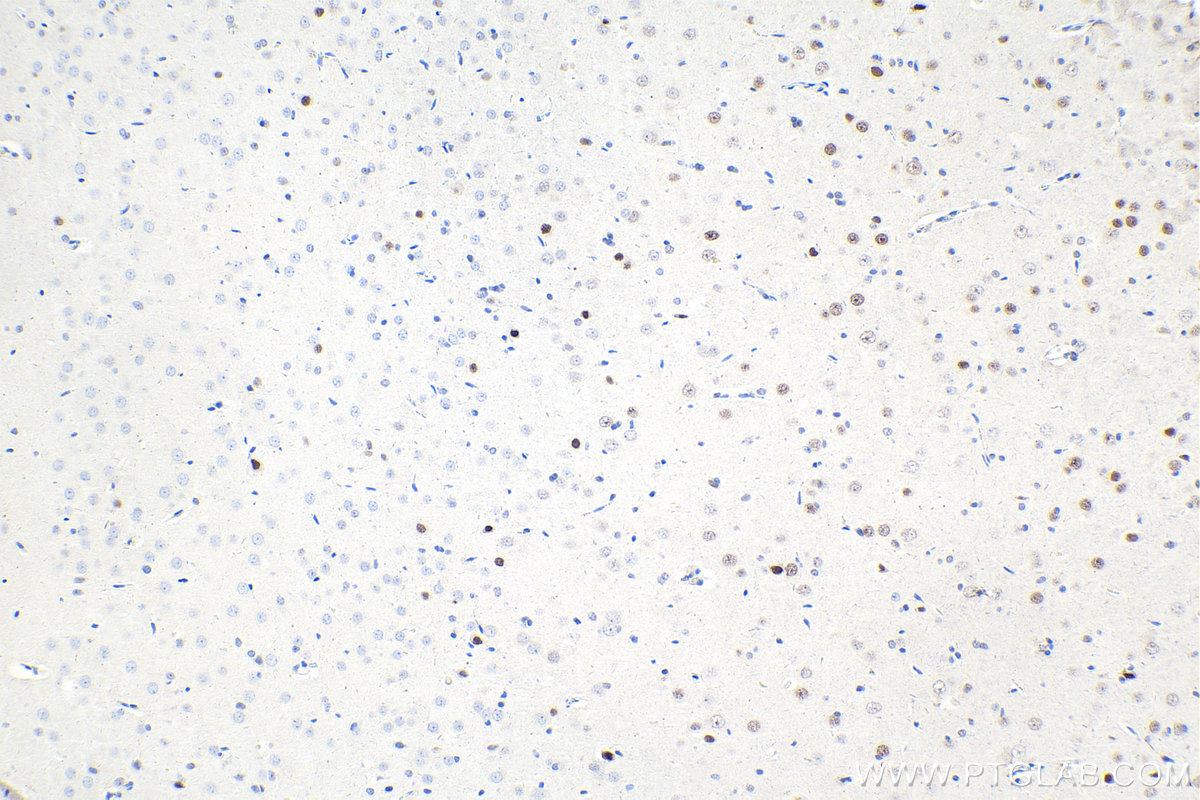 Immunohistochemistry (IHC) staining of rat brain tissue using ESRRG Polyclonal antibody (14017-1-AP)