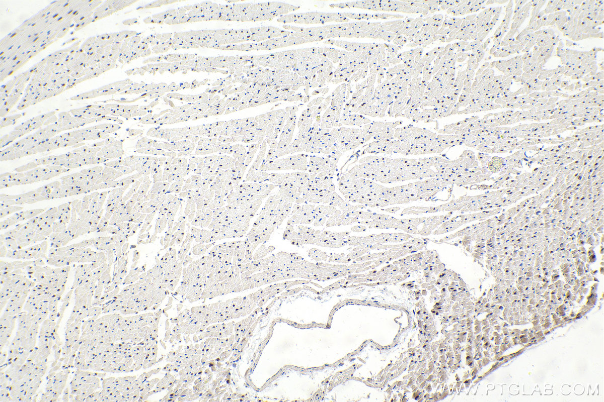 Immunohistochemistry (IHC) staining of rat heart tissue using ESRRG Polyclonal antibody (14017-1-AP)