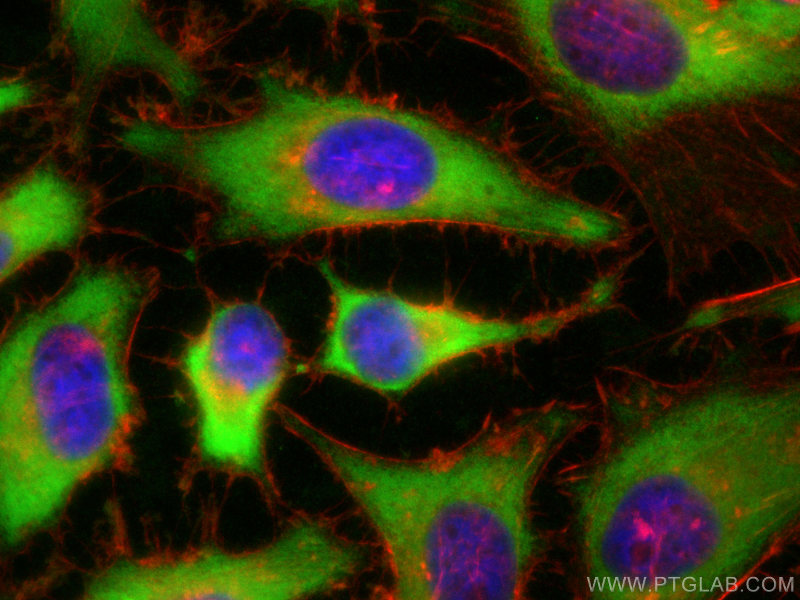 Immunofluorescence (IF) / fluorescent staining of HeLa cells using ETF1 Polyclonal antibody (10884-1-AP)