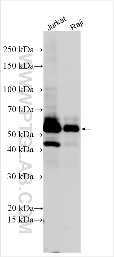 Western Blot (WB) analysis of various lysates using ETS1 Polyclonal antibody (12118-1-AP)