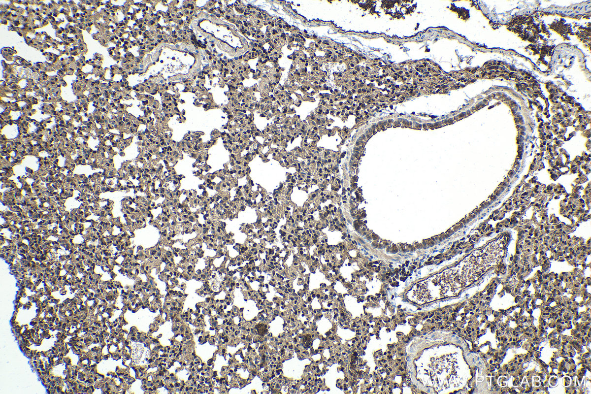 Immunohistochemistry (IHC) staining of mouse lung tissue using ETS1 Monoclonal antibody (66598-1-Ig)