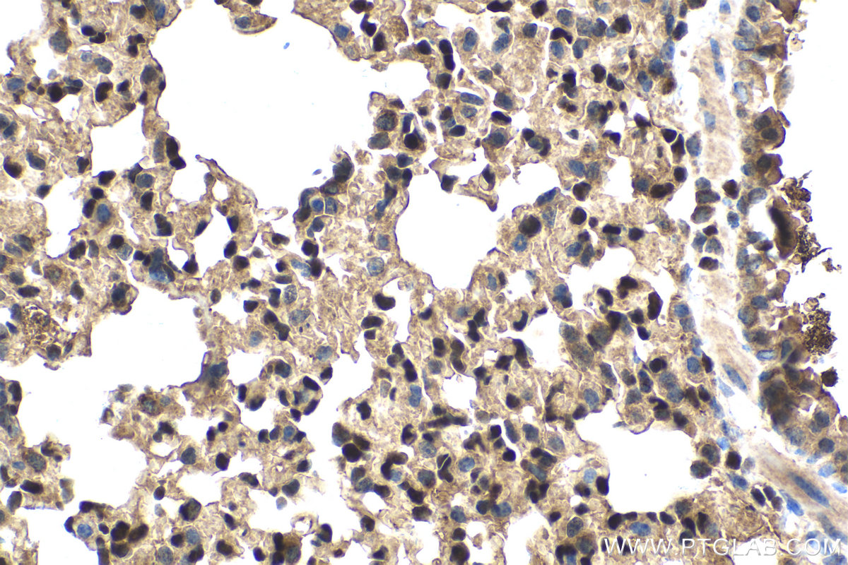 Immunohistochemistry (IHC) staining of mouse lung tissue using ETS1 Monoclonal antibody (66598-1-Ig)