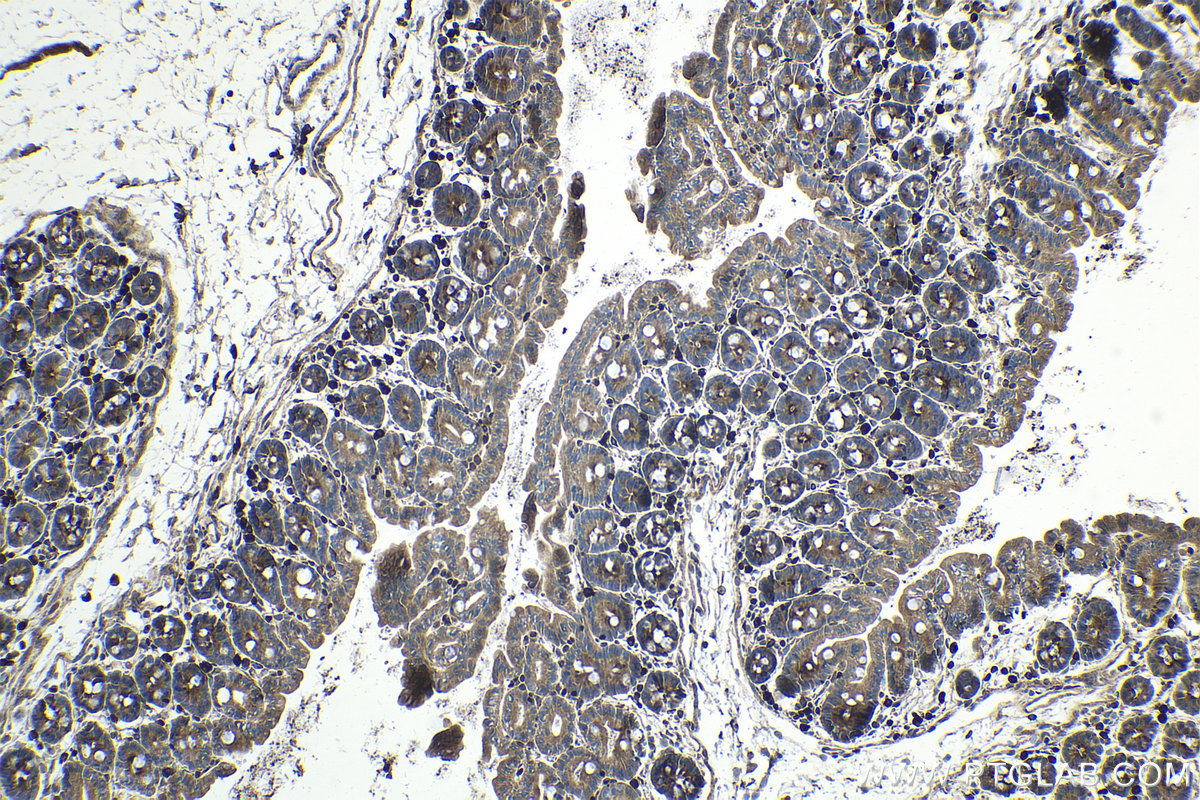 Immunohistochemistry (IHC) staining of mouse small intestine tissue using ETS1 Monoclonal antibody (66598-1-Ig)