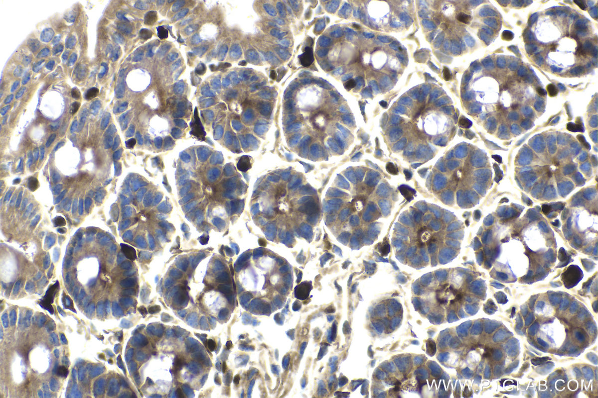 Immunohistochemistry (IHC) staining of mouse small intestine tissue using ETS1 Monoclonal antibody (66598-1-Ig)