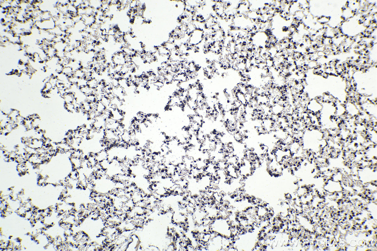 Immunohistochemistry (IHC) staining of rat lung tissue using ETS1 Monoclonal antibody (66598-1-Ig)