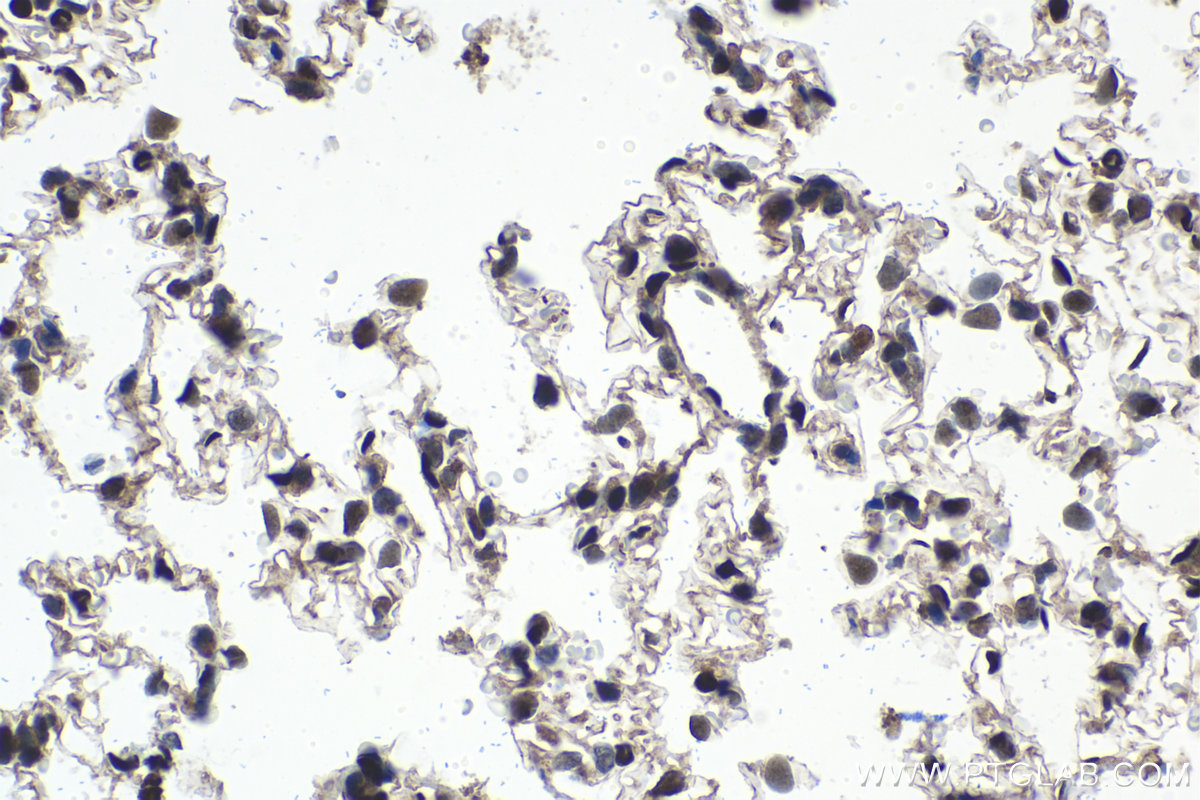 Immunohistochemistry (IHC) staining of rat lung tissue using ETS1 Monoclonal antibody (66598-1-Ig)