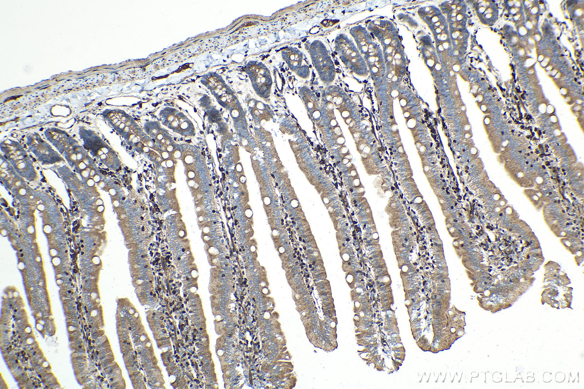 Immunohistochemistry (IHC) staining of rat small intestine tissue using ETS1 Monoclonal antibody (66598-1-Ig)