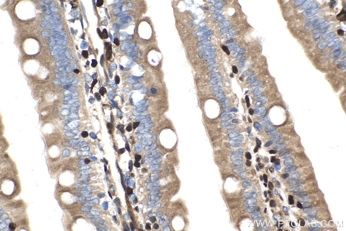 Immunohistochemistry (IHC) staining of rat small intestine tissue using ETS1 Monoclonal antibody (66598-1-Ig)