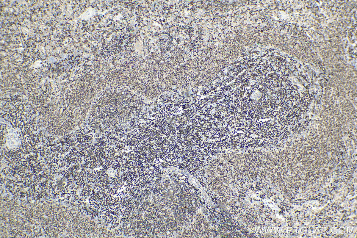 Immunohistochemistry (IHC) staining of rat spleen tissue using ETS1 Monoclonal antibody (66598-1-Ig)