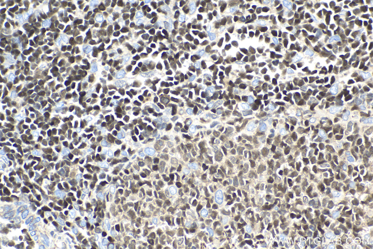 Immunohistochemistry (IHC) staining of rat spleen tissue using ETS1 Monoclonal antibody (66598-1-Ig)