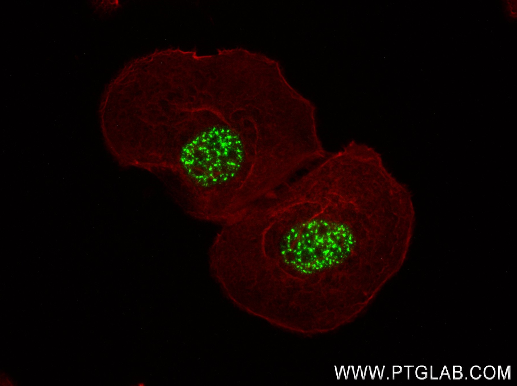 Immunofluorescence (IF) / fluorescent staining of A431 cells using ETV4 Recombinant antibody (83891-6-RR)