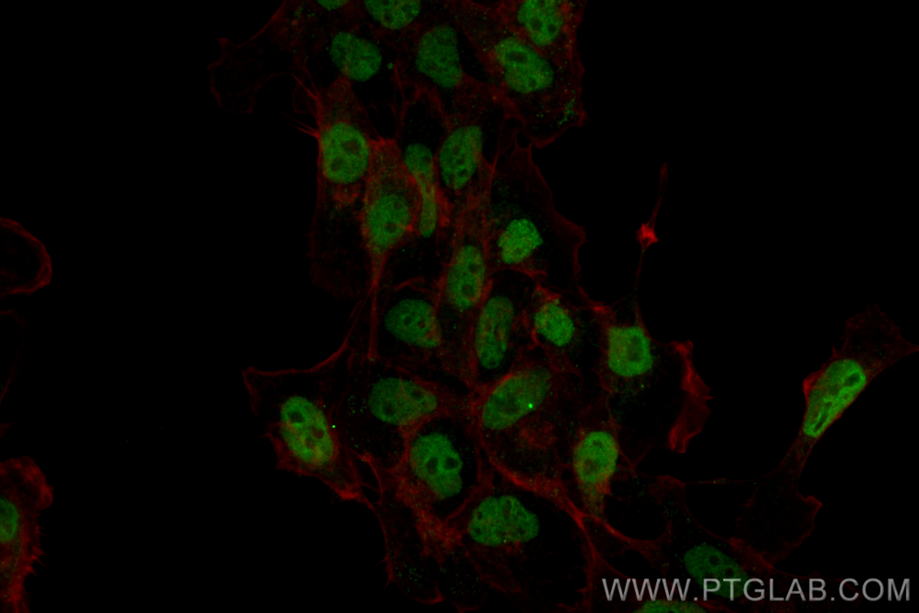 Immunofluorescence (IF) / fluorescent staining of A431 cells using CoraLite® Plus 488-conjugated ETV4 Recombinant ant (CL488-83891-6)