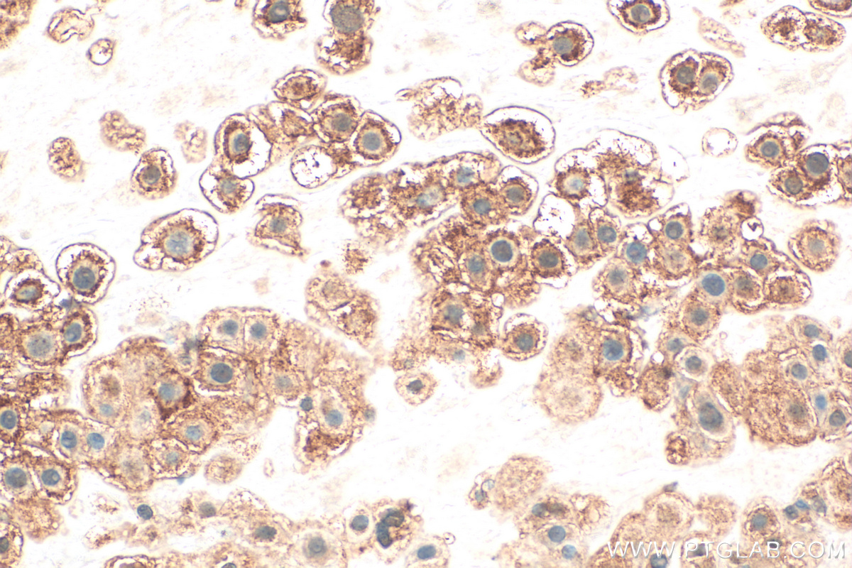 Immunohistochemistry (IHC) staining of human placenta tissue using EVC2 Polyclonal antibody (55367-1-AP)