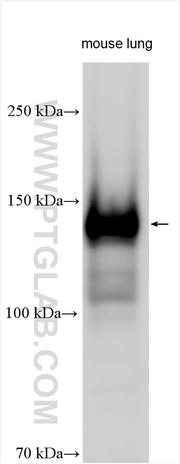 Western Blot (WB) analysis of various lysates using EVC2 Polyclonal antibody (55367-1-AP)