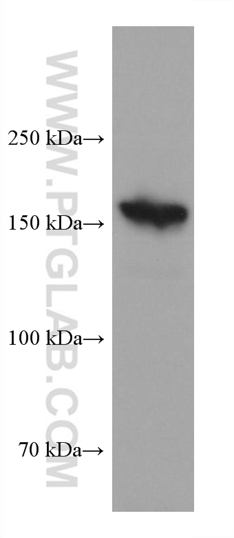 Western Blot (WB) analysis of MKN-45 cells using EVI1 Monoclonal antibody (60413-1-Ig)