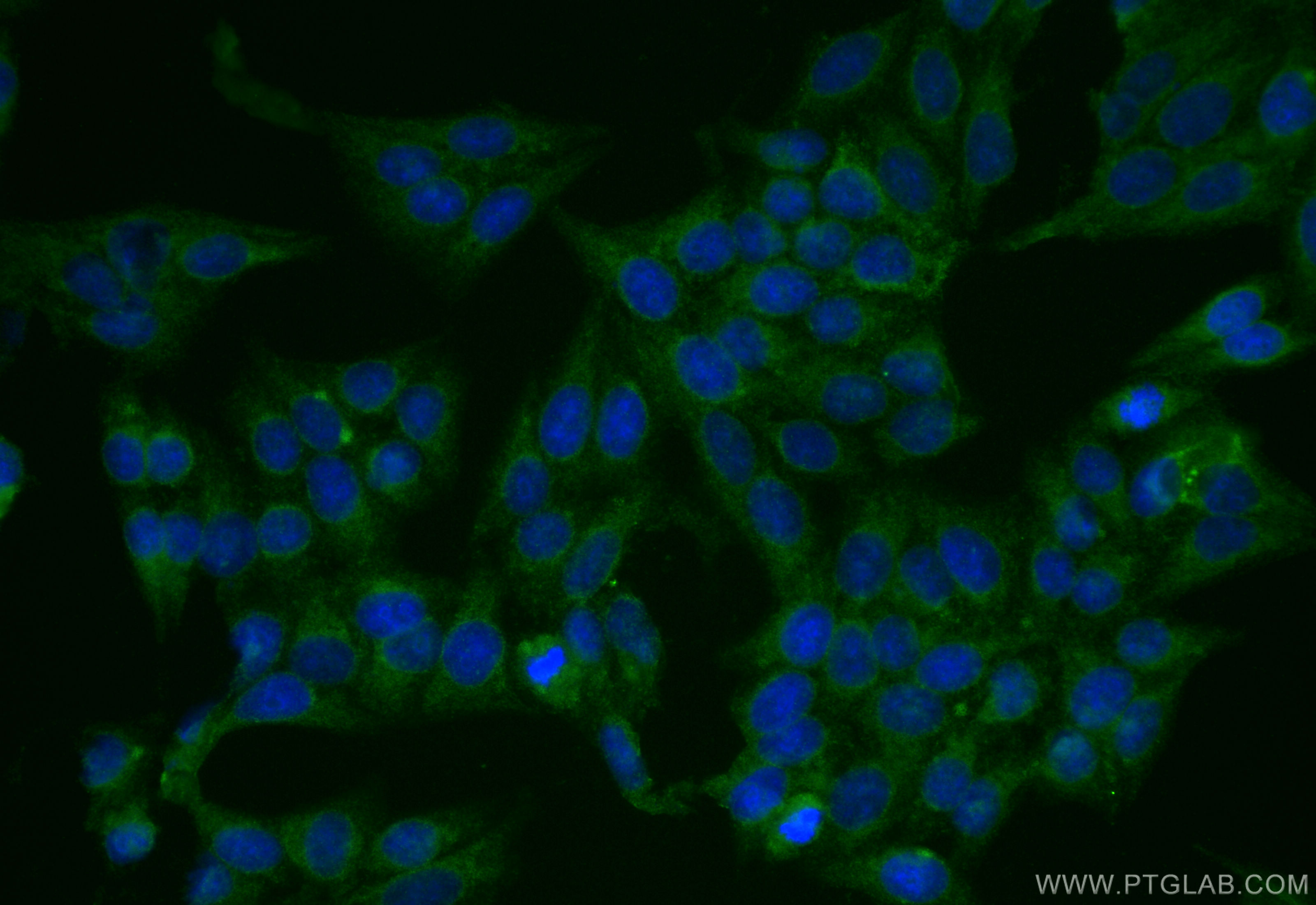 Immunofluorescence (IF) / fluorescent staining of HepG2 cells using EVI2A Polyclonal antibody (17415-1-AP)