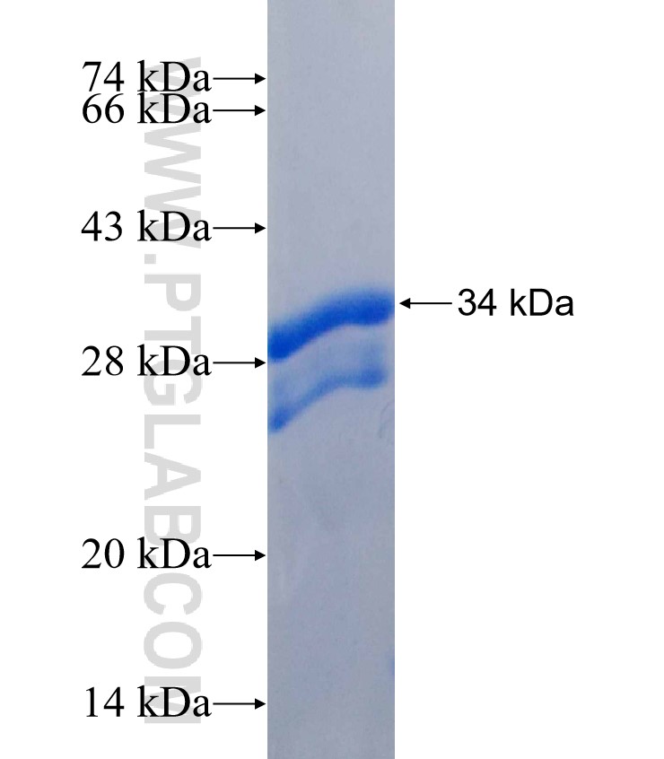 EVI5 fusion protein Ag26739 SDS-PAGE