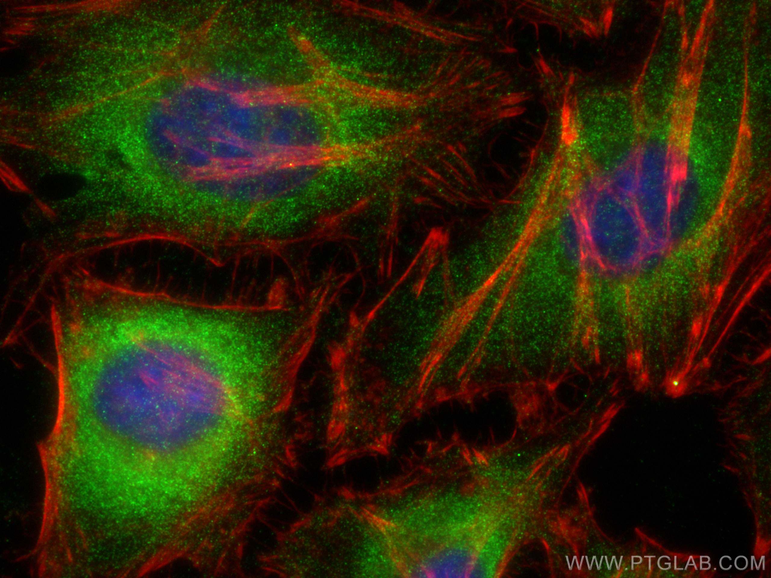 Immunofluorescence (IF) / fluorescent staining of HeLa cells using EXD1 Polyclonal antibody (17313-1-AP)