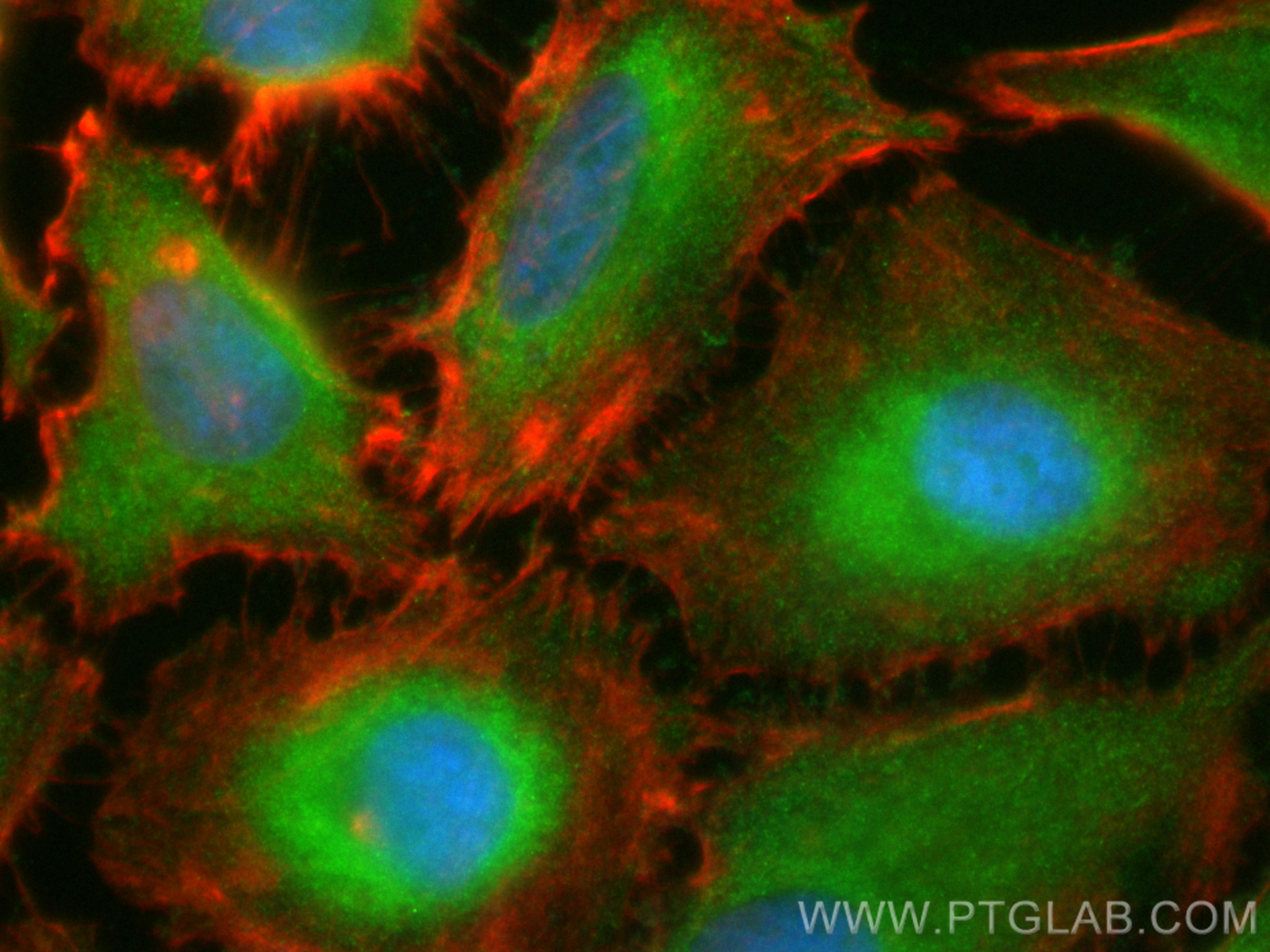 Immunofluorescence (IF) / fluorescent staining of HeLa cells using CoraLite® Plus 488-conjugated EXD1 Polyclonal anti (CL488-17313)