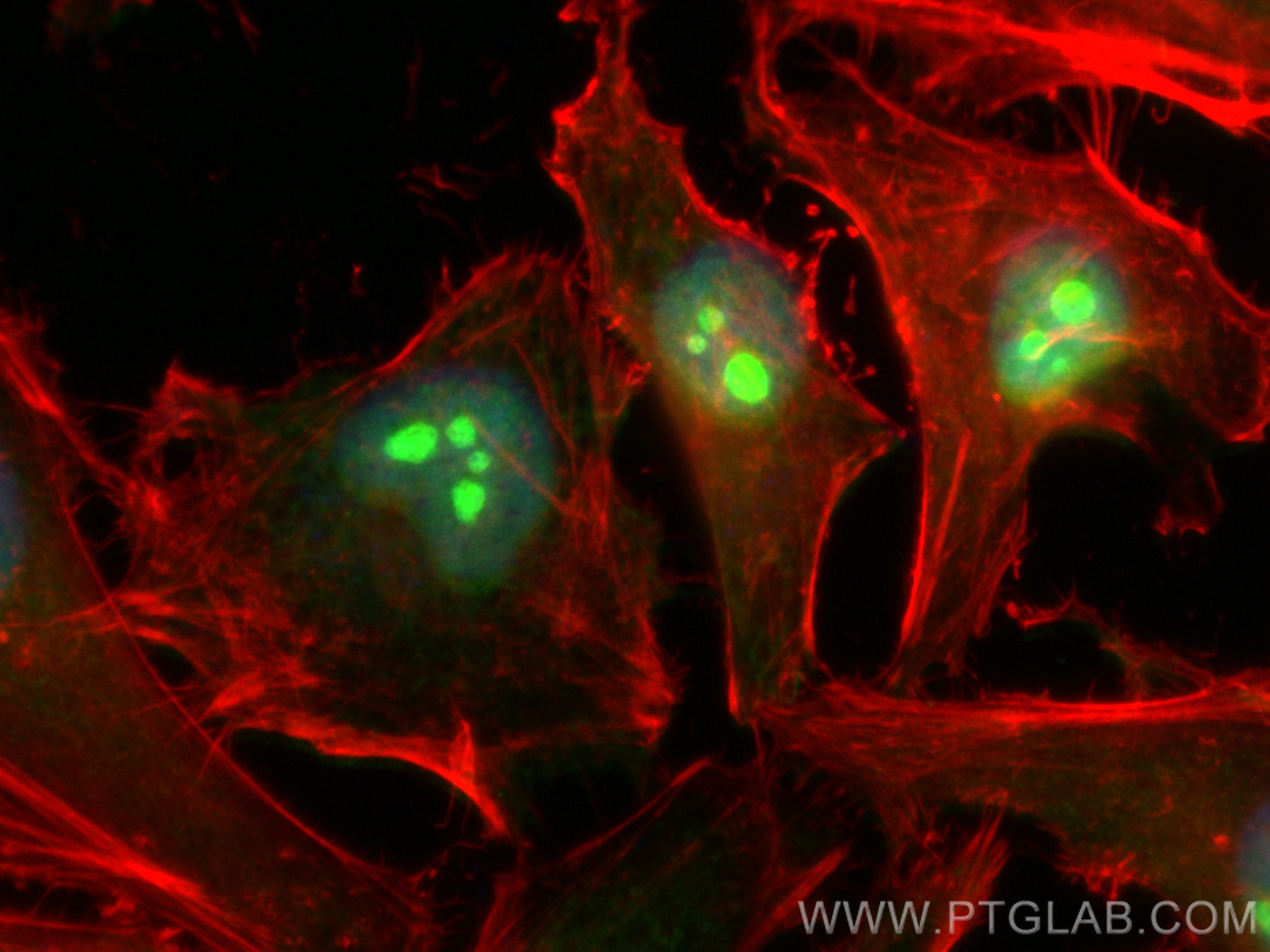Immunofluorescence (IF) / fluorescent staining of HeLa cells using CoraLite® Plus 488-conjugated EXOSC10 Polyclonal a (CL488-16731)