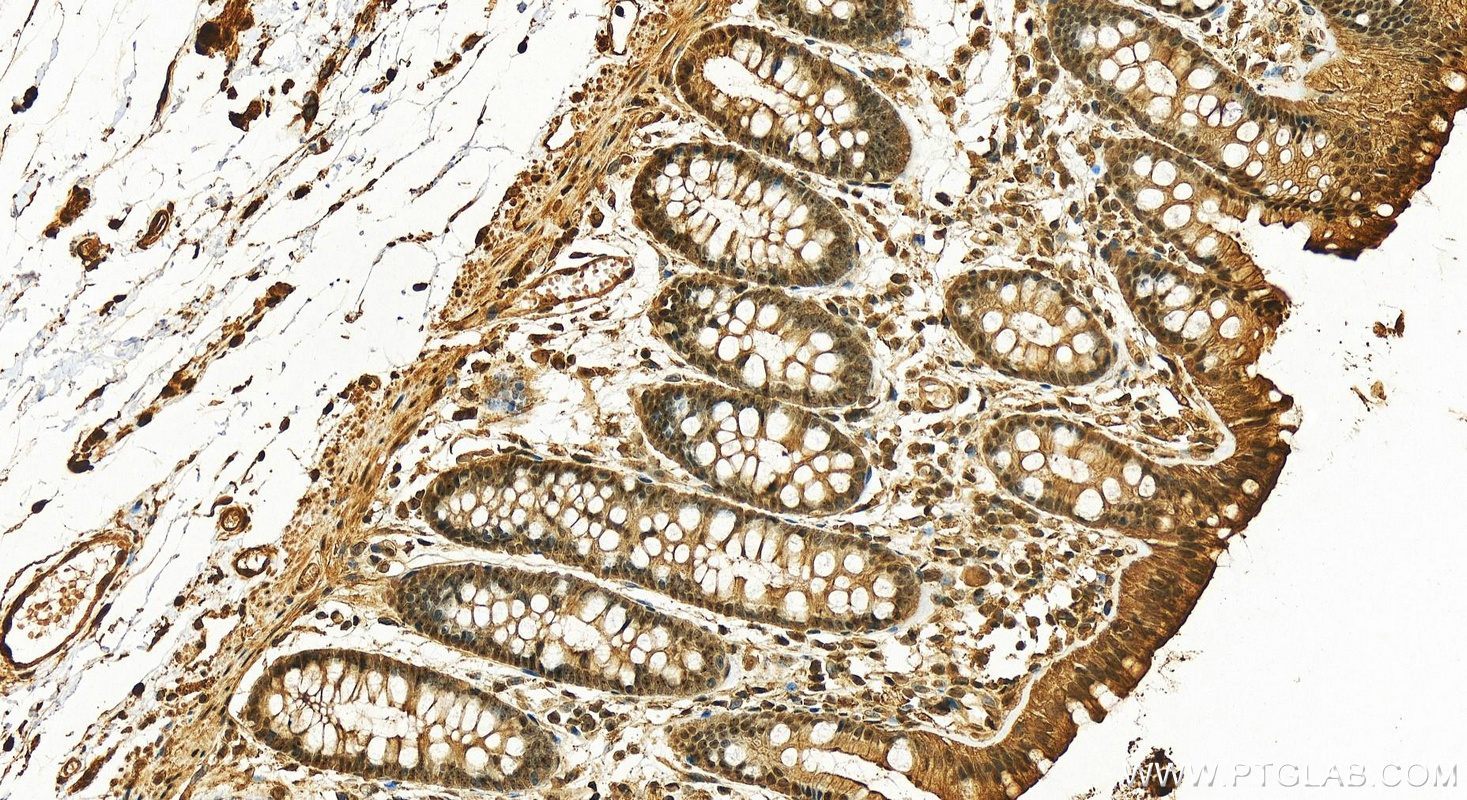 Immunohistochemistry (IHC) staining of human colon tissue using EXOSC7 Polyclonal antibody (25292-1-AP)