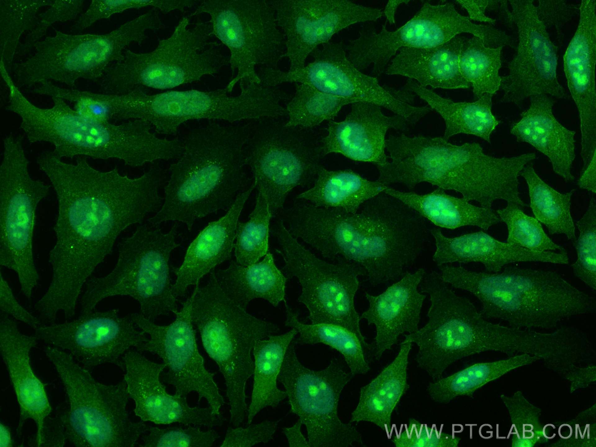 Immunofluorescence (IF) / fluorescent staining of HeLa cells using EXOSC7 Polyclonal antibody (25292-1-AP)