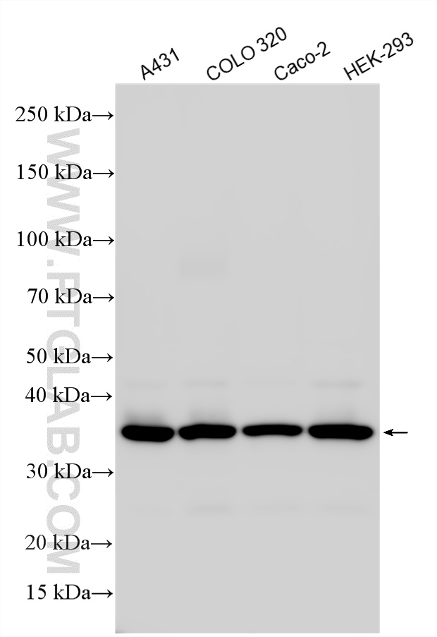 Western Blot (WB) analysis of various lysates using EXOSC7 Polyclonal antibody (25292-1-AP)