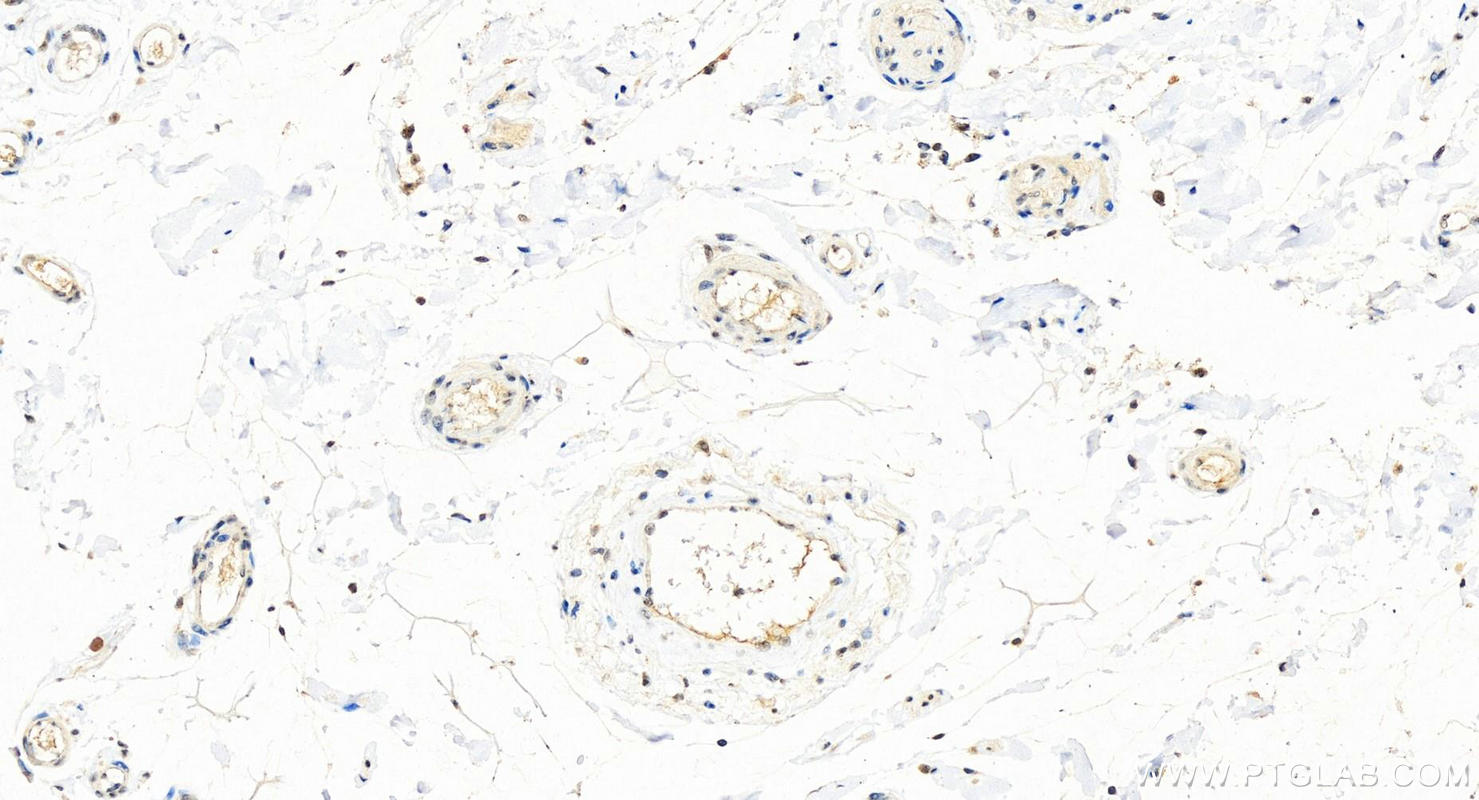 Immunohistochemistry (IHC) staining of human colon tissue using EXOSC8 Polyclonal antibody (11979-1-AP)