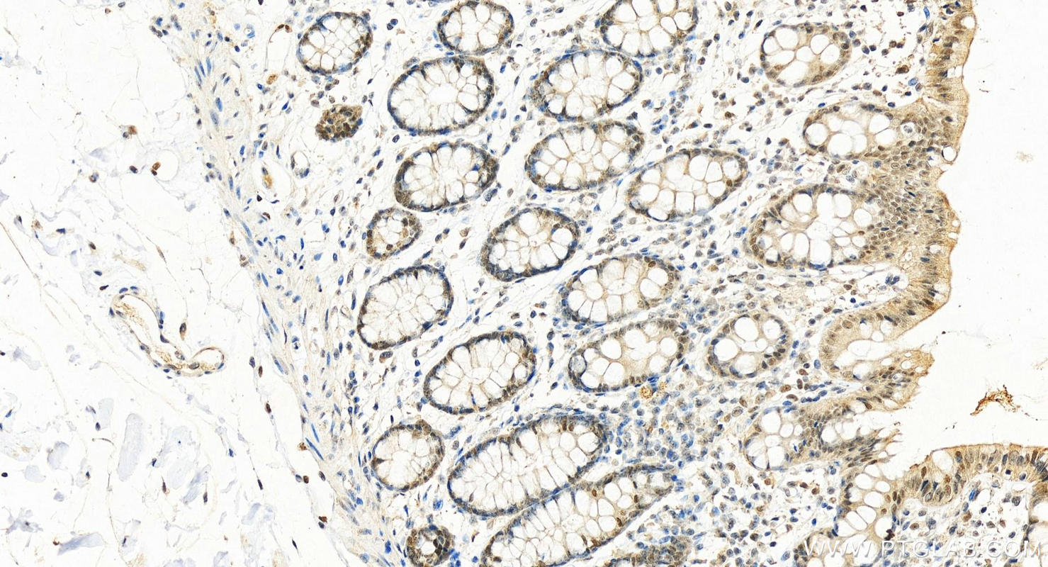 Immunohistochemistry (IHC) staining of human colon tissue using EXOSC8 Polyclonal antibody (11979-1-AP)