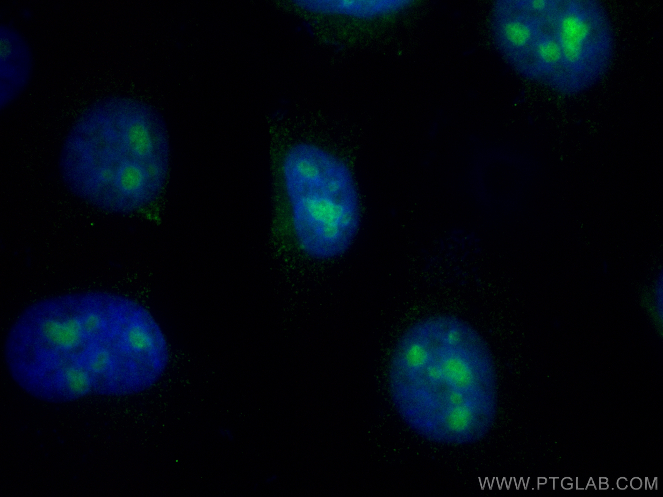 Immunofluorescence (IF) / fluorescent staining of HeLa cells using CoraLite® Plus 488-conjugated EXOSC9 Monoclonal an (CL488-67636)