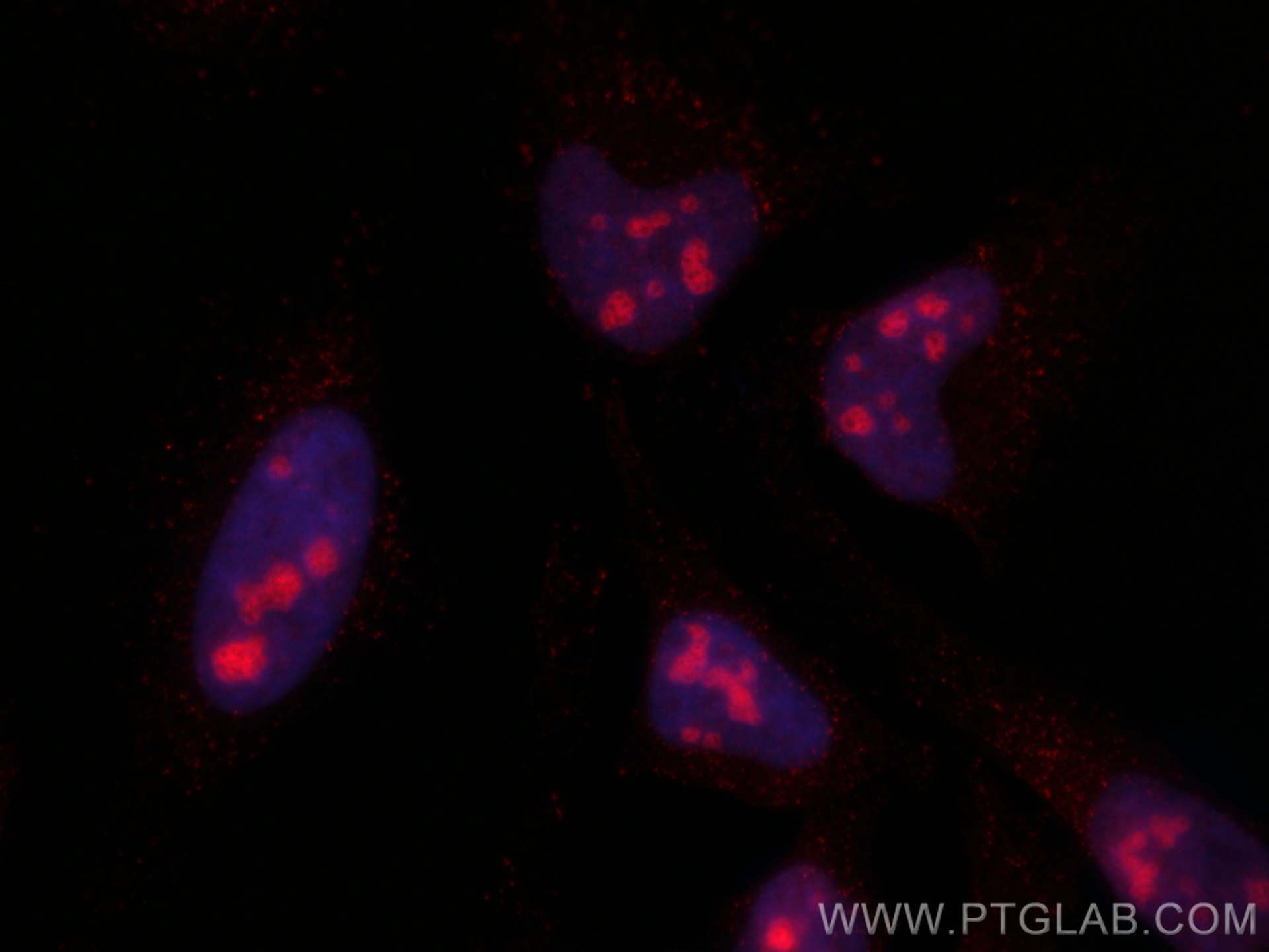 Immunofluorescence (IF) / fluorescent staining of HeLa cells using CoraLite®594-conjugated EXOSC9 Monoclonal antibody (CL594-67636)