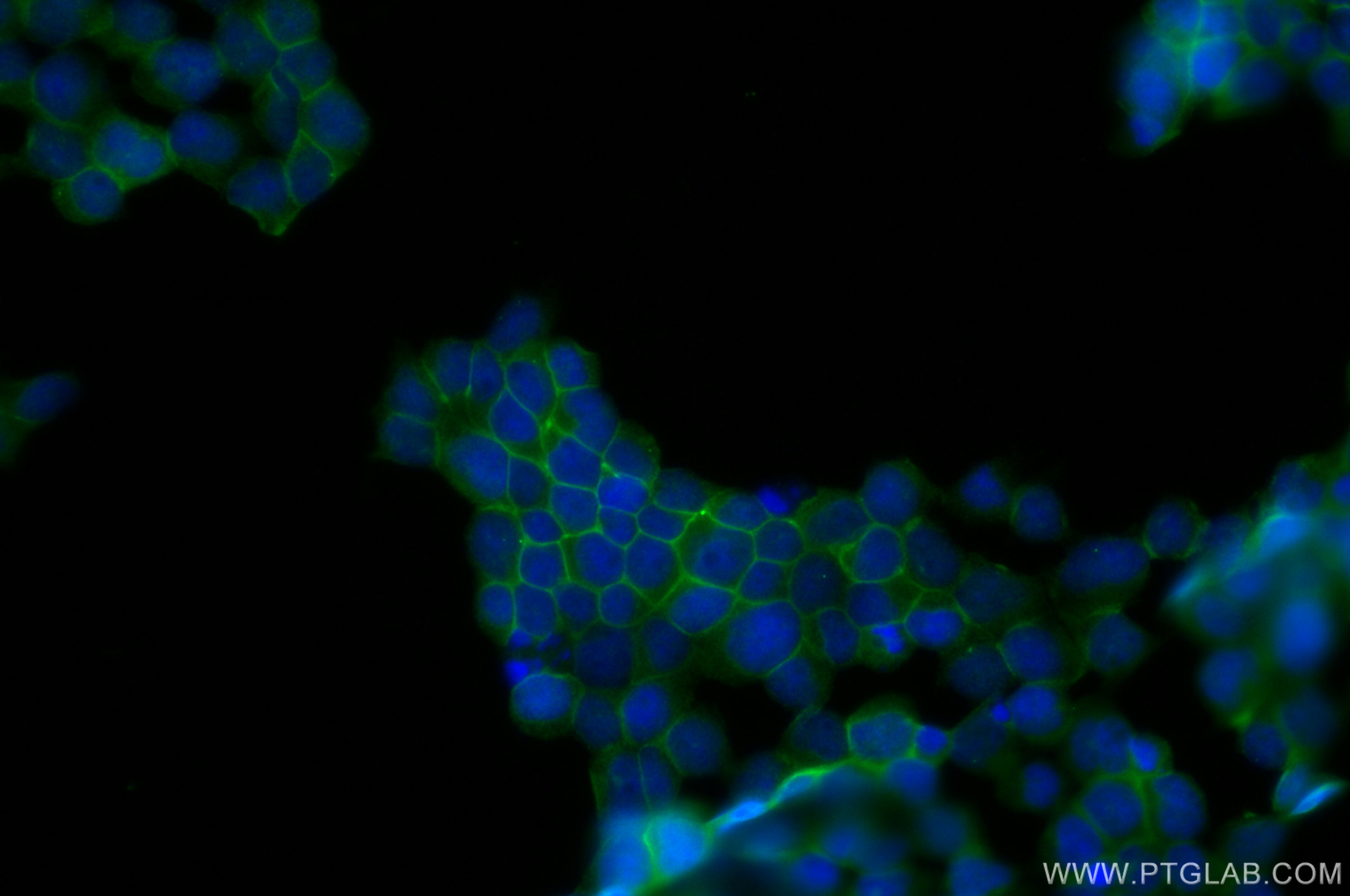 Immunofluorescence (IF) / fluorescent staining of Jurkat cells using EXT2 Polyclonal antibody (11348-1-AP)