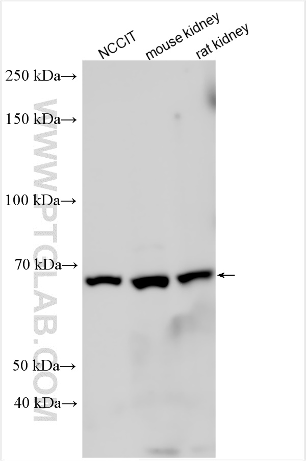 Western Blot (WB) analysis of various lysates using EYA1 Polyclonal antibody (31435-1-AP)