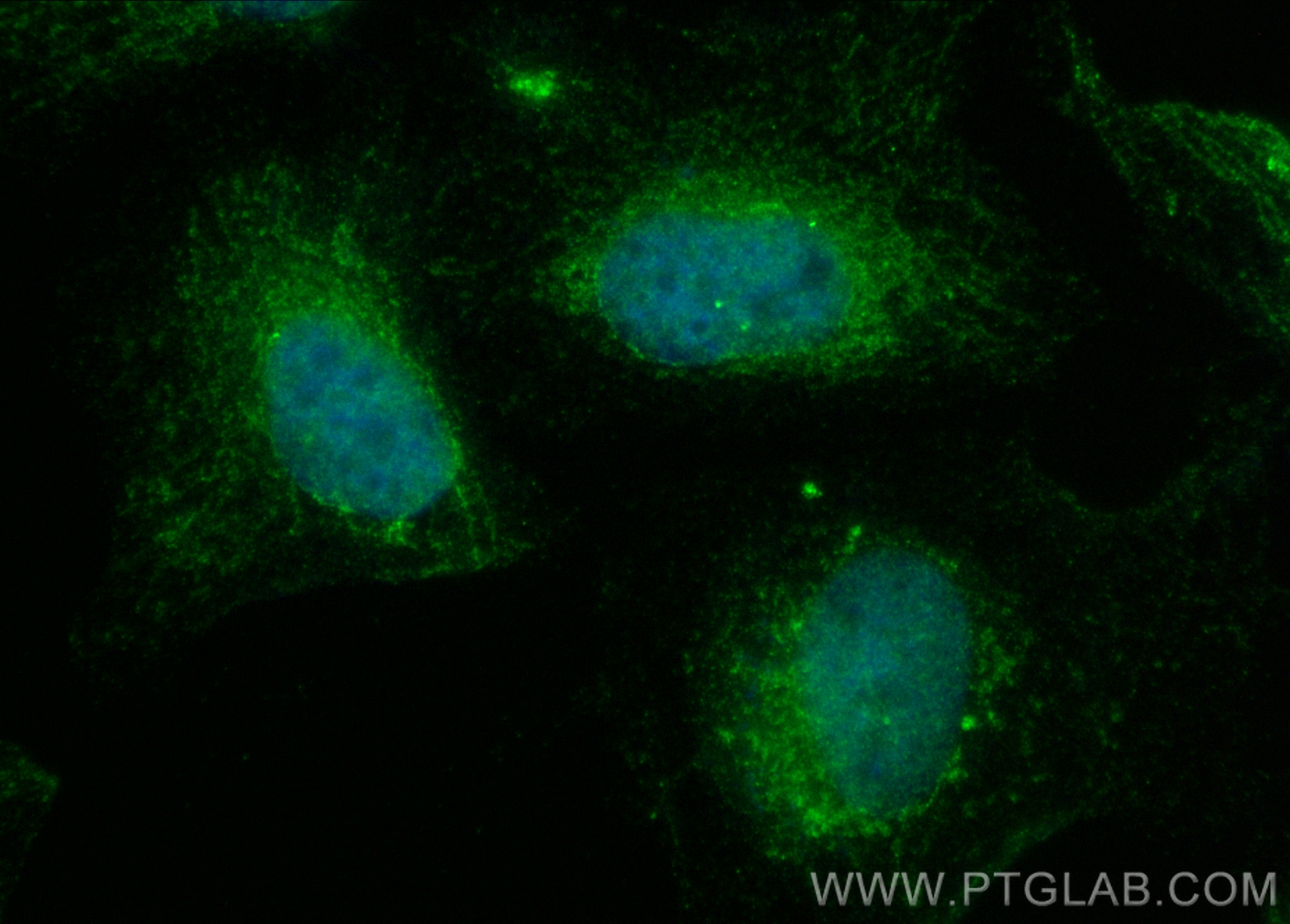 Immunofluorescence (IF) / fluorescent staining of HeLa cells using CoraLite® Plus 488-conjugated EYA1 Polyclonal anti (CL488-22658)